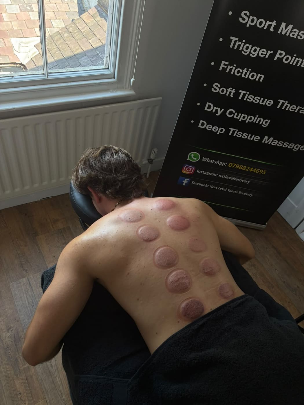 After cupping